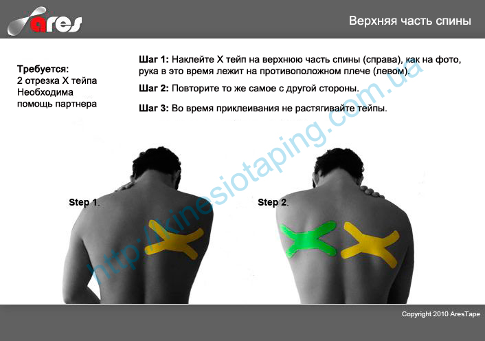 Лечение боли в верхней части спины методом кинезиотейпирования : Купить кинезио тейп недорого