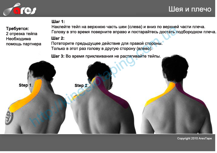 Лечение боли в области шеи и плеча методом кинезиотейпирования : Купить кинезио тейп в Херсоне