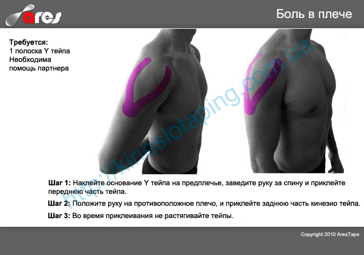 Лечение вывиха плеча методом кинезиотейпирования : Купить кинезио тейп в Донецке