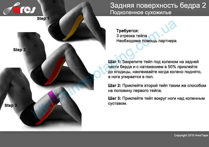 Лечение мышц задней поверхности бедра методом кинезиотейпирования : Купить кинезио тейп производства корея