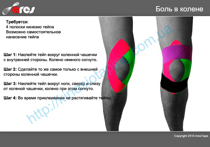 Боль в колене лечим методом кинезиотейпирования : Болит колено - купи кинезио тейп