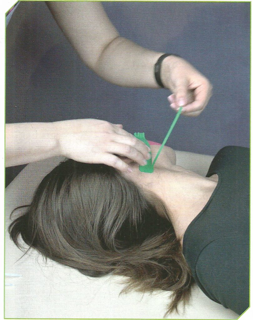 Фото инструкция дренажной техники кинезио тейпирования лица
