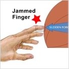 Кинезио тейп для лечения выбитого пальца : Как использовать кинезио тейп при выбитом пальце